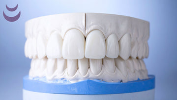 Full Set up Upper Porcelain Veneers on Cast Models