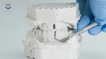 2 cast models misaligned showing incorrect bite